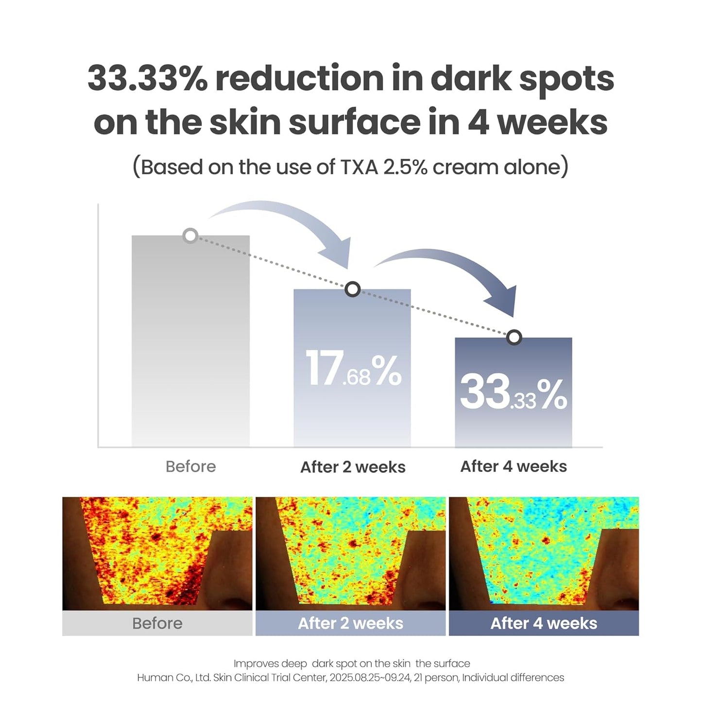 AXIS-Y TXA 2.5% Intensive Brightening Cream – Dark Spot Corrector & Skin Tone Enhancer