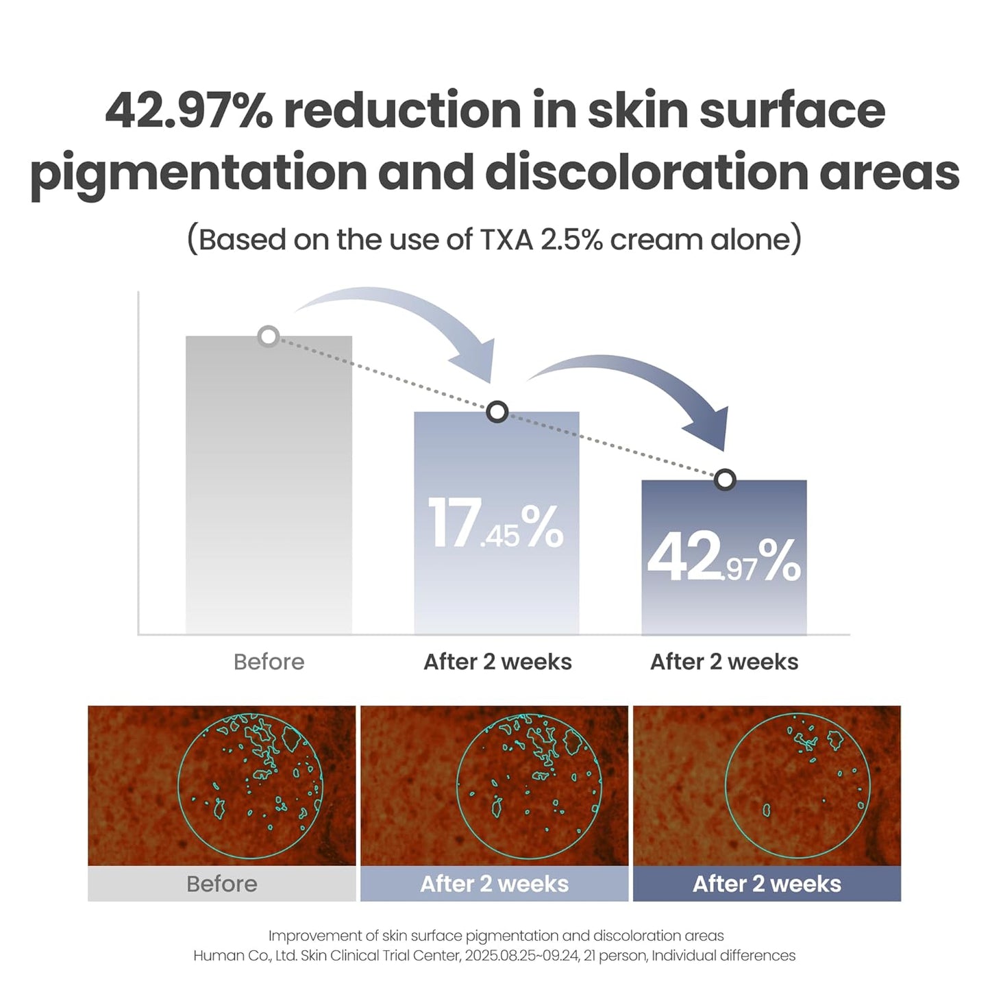 AXIS-Y TXA 2.5% Intensive Brightening Cream – Dark Spot Corrector & Skin Tone Enhancer