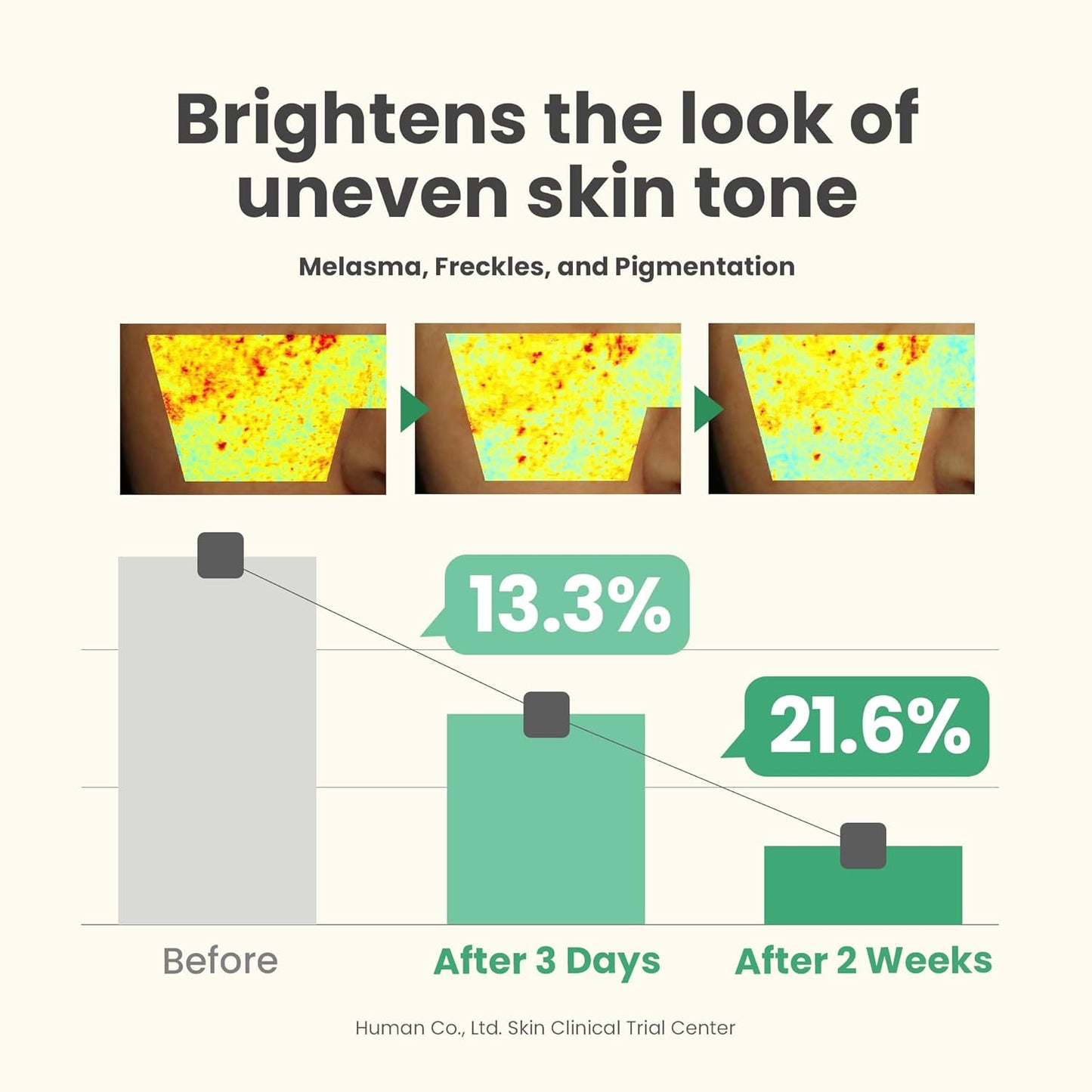 AXIS-Y Dark Spot Correcting Glow Serum – Brightening Niacinamide Serum for Clear Skin